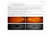 7) PATOLOGIAS VASCULARES RETINOPATIA DIABÉTICA …antonioramalho.com/direscrita/ficheiros/PARTE 2 - PATOLOGIAS... · A retinopatia hipertensiva é caracterizada por uma atenuação