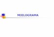 MIELOGRAMA - Stoa Social · Indicações do mielograma ... JUNTA COM OS ACHADOS DO HEMOGRAMA (de preferência o sangue periférico deve ser colhido no mesmo dia da coleta do mielograma)