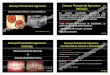 Doença Periodontal Agressiva:Doença Periodontal Agressiva ...periodonto.net/materialdidatico/aulas/Doenca_Periodontal_Agressiva.pdf · Doença periodontal crônica AAP 1999 Doença