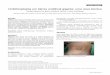 Umbilicoplastia em hérnia umbilical gigante: uma nova técnica · 1. marcação de quatro pontos (Figura 3): 5. isolamento e reparo da falha aponeurótica no sentido transversal