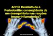Artrite Reumatóide e Periodontite: conseqüência de um ...periodontiamedica.com.br/wp-content/uploads/2011/05/artrite-perio... · Periodontite: conseqüência de um desequilíbrio