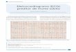 Eletrocardiograma (ECG) preditor de morte súbitadocs.bvsalud.org/biblioref/2017/05/833695/rdt_v22n2_75-77.pdf · síncope e/ou morte súbita em pacientes com coração es-truturalmente