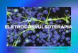 ELETROCONVULSOTERAPIA - neurohealth.com.brneurohealth.com.br/wp-content/uploads/2017/07/aperject.pdf · Os novos aparelhos usam onda quadrada e pulso breve. Este avanço ... neuronios