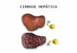 [PPT]CIRROSE HEPÁTICA I Etiologia - Turma3 | … · Web viewCIRROSE HEPÁTICA CIRROSE HEPÁTICA - ETIOLOGIA Causas mais frequentes: Álcool Hepatite crónica B ou C Fígado gordo