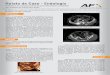 Relato de Caso - Endologix de Caso 3.pdfRelato de Caso - Endologix Tratamento da dissecção crônica da aorta descendente complicada com dilatação da artéria ilíaca direta Dr
