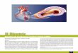 II Diretriz - publicacoes.cardiol.brpublicacoes.cardiol.br/consenso/pocketbook/2005-2009/12-ica.pdf · Suporte mecânico respiratório não invasivo (CPAP ou BiPAP) para pacientes