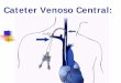 Cateter Venoso Central - irp-cdn. 7...  A contamina§£o bacteriana do cateter venoso central tem