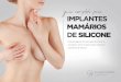 DE SILICONE muitas razões pelas quais as mulheres podem considerar a cirurgia de aumento de mama, entre elas: Aparência Os implantes mamários são capazes de tornar os seios maiores,