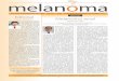 melanoma - GBMmelanoma da região palmar ou plantar ge ralmente produz defeitos que não po - dem ser fechados com sutura primária. Quando ocorre em local que não suporta peso, como