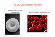 LES ANEMIES HEMOLYTIQUESuniv.ency-education.com/uploads/1/3/1/0/13102001/hemato4... · 2018-09-07 · B. Hémoglobinose S = drépanocytose : Anémie hémolytique corpusculaire héréditaire