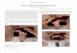 Placa alopécica frontoparietal - SciELO Españascielo.isciii.es/pdf/sm/v73n1/imagen_problema.pdf · 2017-04-10 · so, con superficie lisa y por plegarse con facilidad. El signo