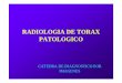 RADIOLOGIA DE TORAX PATOLOGICO · PDF file 2013-08-23 · patologias pulmonares • opacidades • alveolares » por ocupaciÒn (consolidaciÒn) » por reabsorciÒn (atelectasia) •