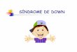 SÍNDROME DE DOWN - Amazon S3 · SÍNDROME DE DOWN. É uma cromossomopatia, cujo quadro clínico global deve ser explicado por um desequilíbrio na constituição cromossômica (presença
