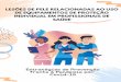 Covid-19 frente à Pandemia por Estratégias de Prevenção · 2020-04-20 · LESÕES DE PELE RELACIONADAS AO USO DE EQUIPAMENTOS DE PROTEÇÃO INDIVIDUAL EM PROFISSIONAIS DE SAÚDE