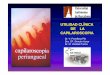 UTILIDAD CLÍNICA DE LA CAPILAROSCOPIA · 2015-11-10 · Sebastiani M et al. Ann Rheum Dis. 2011. CAPILAROSCOPIA y ENFERMEDAD Diagnóstico - Pronóstico Acrosíndromes vasculares