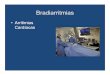 Arritimias Cardíacas · 2019-12-10 · Taquiarritmias Extra-sístoles Taquicardias SV Taquicardia ventricular Flutter atrial / ventricular Fibrilação atrial / ventricular. Farmacologia