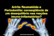 Artrite Reumatóide e Periodontite: conseqüência de um ... … · Artrite Idiopática Juvenil Quando os sinais da artrite crônica ocorrem em crianças e adolescentes antes dos