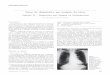 Curso de diagnóstico por imagem do tórax · 328 J Pneumol 25(6) – nov-dez de 1999 dular ou tubular (Figura 3) e, algumas vezes, a aparência em “dedo de luva”, tipicamente