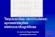 Taquicardias ventriculares: apresentações eletrocardiográficas · Quando a TV tem origem na região basal do VE, o eixo de despolarização ventricular está dirigido inferiormente,