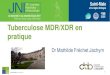 Tuberculose MDR/XDR en pratique - Infectiologie18es JNI, Saint -Malo, du 21 au 23 juin 2017 Méta-analyse : 537 patients MDR-TB Pym . ERJ 2015 phase II, multicentrique (n=205) Ndjeka