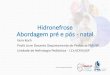 Hidronefrose Abordagem pré e pós - natal...2020/02/01  · O que é hidronefrose? •Hidronefrose (HN) é a dilatação do sistema coletor renal. Quando inclui a dilatação dos