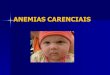 ANEMIAS CARENCIAIS · PDF file

ANEMIA FERROPRIVA Incidência: 40% das crianças na Região Sul 60% das crianças na Região Nordeste